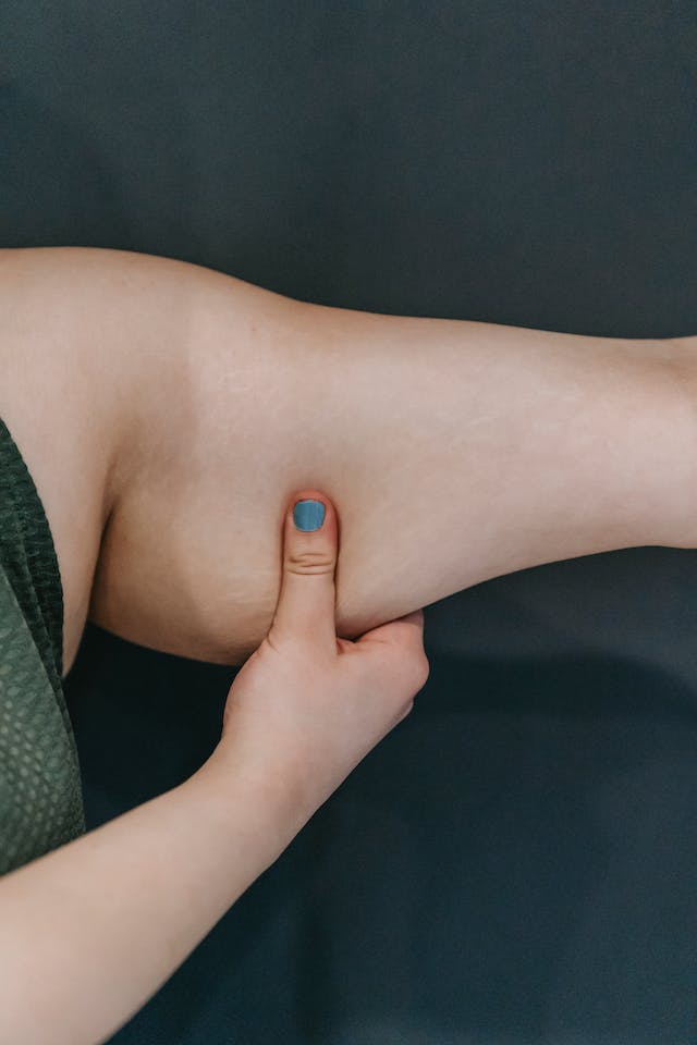 A woman pulling the skin of her tricep.